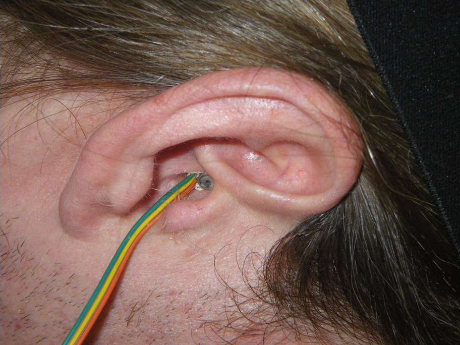 3 image ear right_nh1192.jpg